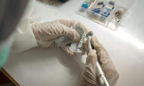 Warum ein eigenes Dentallabor den Unterschied macht: Zahnersatz aus einer Hand