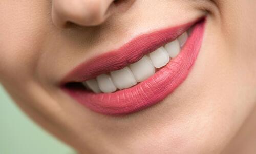 Wie entstehen Zahnverfärbungen und was hilft wirklich dagegen?