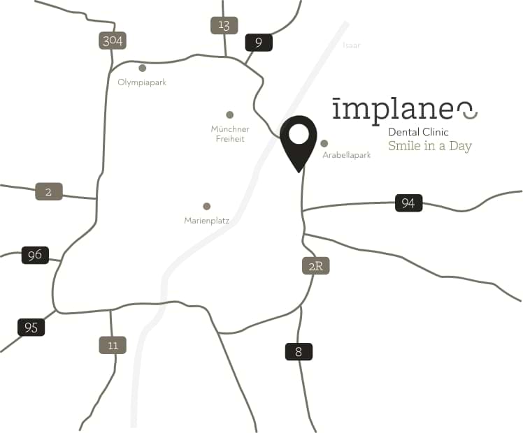 Ihr Weg zu uns: implaneo Karte